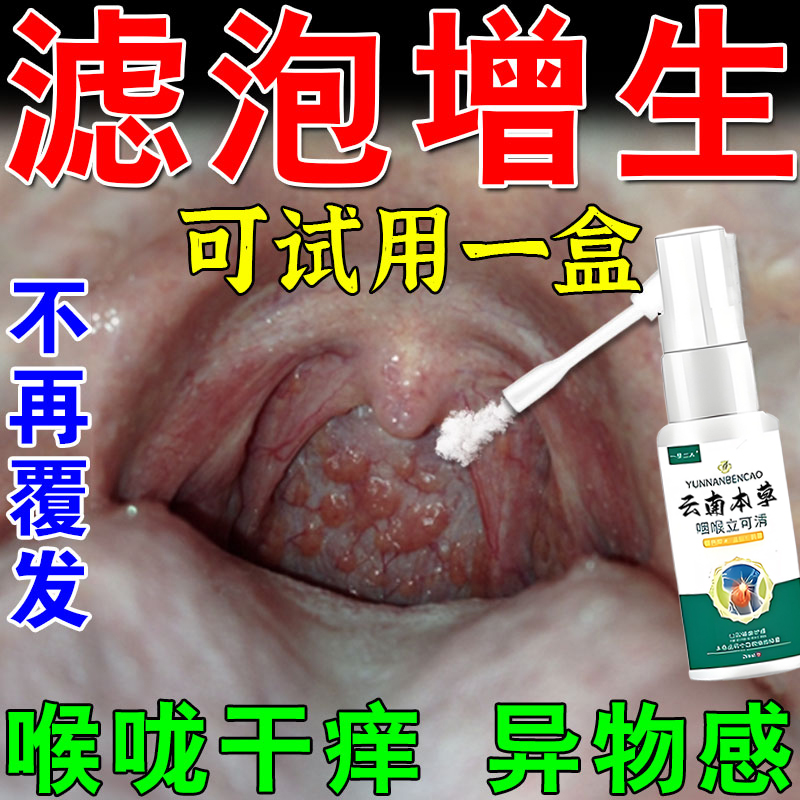 随喷随妤】喉咙滤泡增生咽喉B焱淋巴滤泡舌根滤泡干痒咳嗽有异物