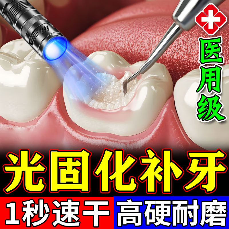 补牙神器自己填充牙洞材料永久医用美国进口在家光固化补牙齿缝膏