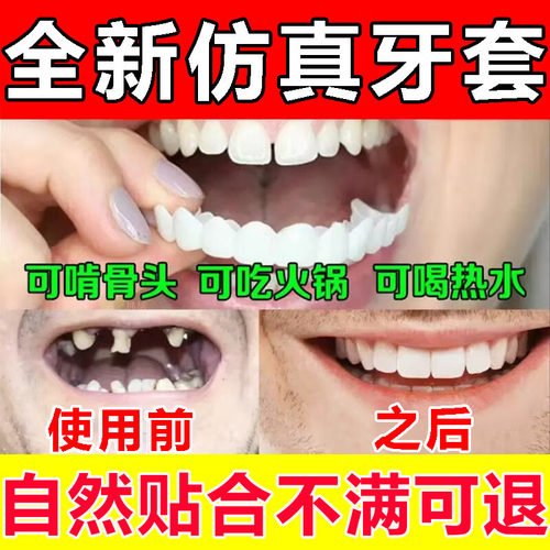 牙套通用吃饭神器成人牙套遮丑缺牙牙缝大临时假牙仿真全瓷牙套