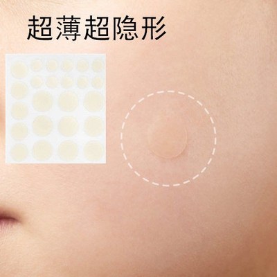 遮痣贴凹凸疤痕遮盖贴遮瑕贴黑痣脸部的超薄隐形贴神器痘痘贴