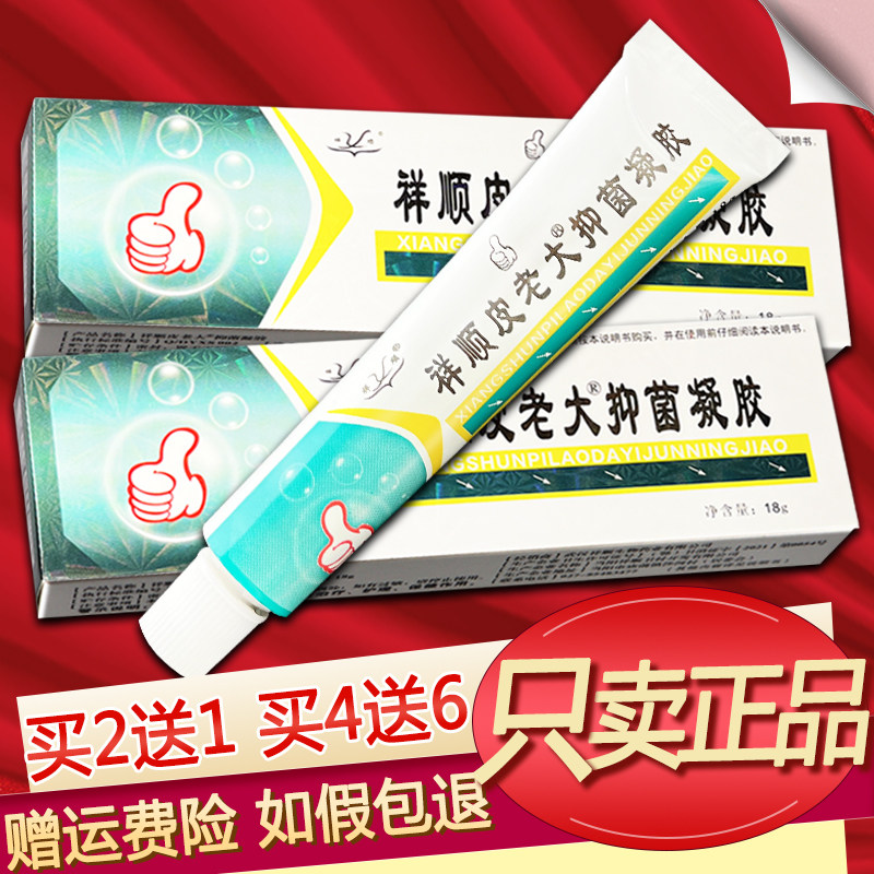 祥顺皮老大软膏草本凝胶