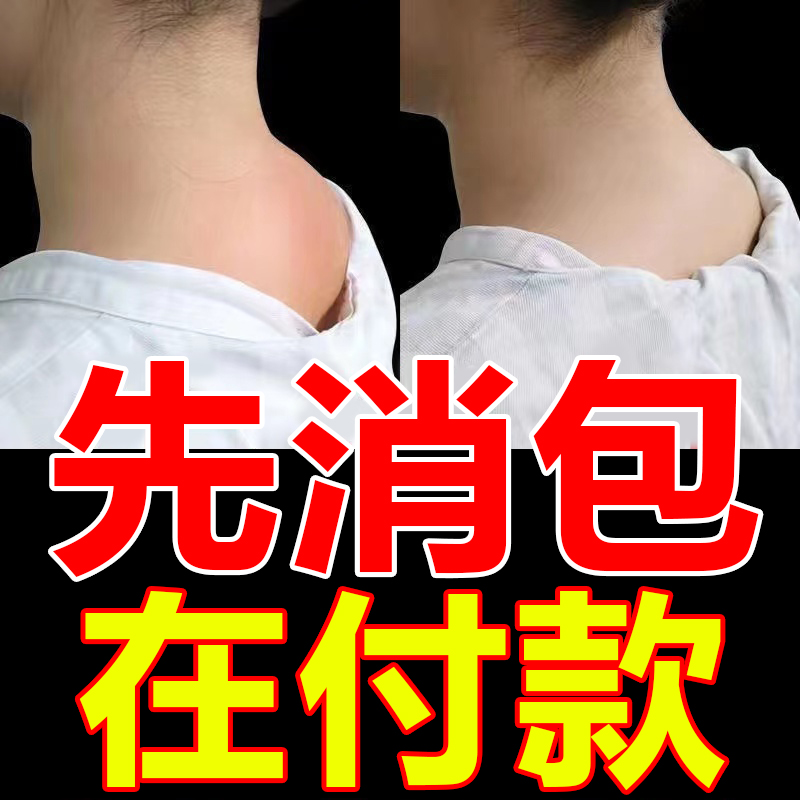 富贵包消除贴正品颈椎疼痛专用贴膏修复脖子鼓包疏通矫正器连裉拨