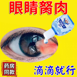 眼博士除眼睛胬肉滴眼液眼角有胬肉翼状胬肉浊翼状滴眼液