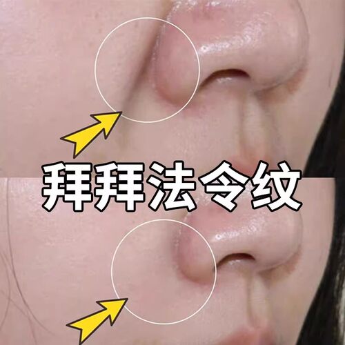 【买1送1 含有胶原蛋白法令纹贴】淡化法令纹贴 注氧精华敏感肌肤