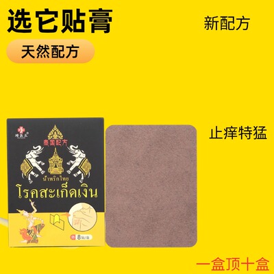 皮焱痒荨麻疹贴膏牛皮藓止痒贴真菌感染大腿内侧瘙痒真菌感染