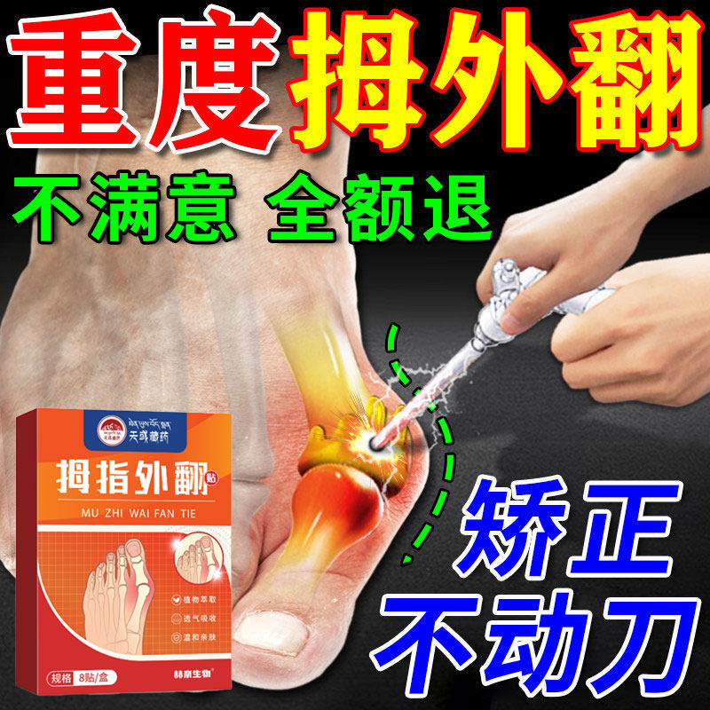 拇指外翻膏药贴大拇指疼痛关节畸形拇囊炎脚趾痛大脚骨专用矫正贴