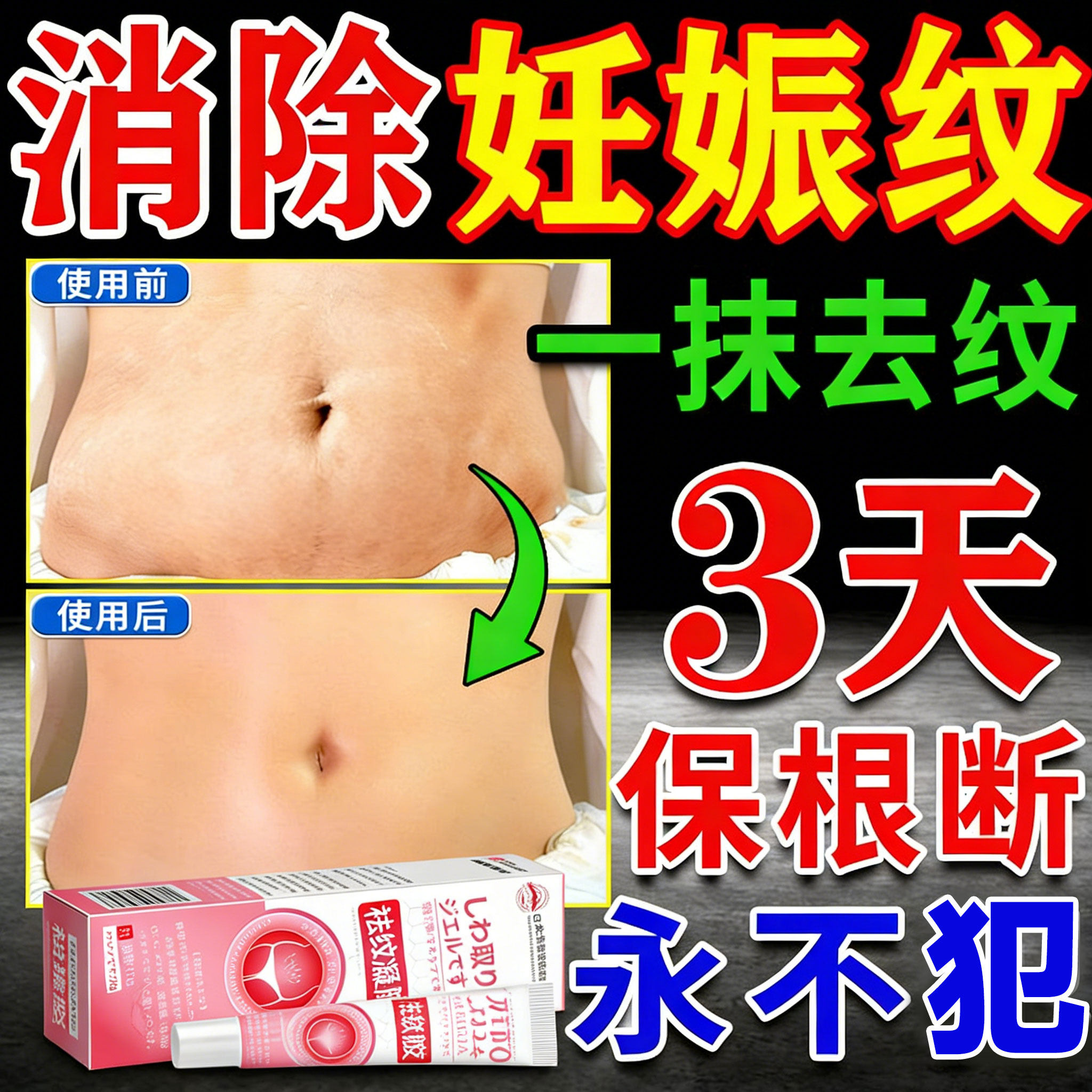 妊娠纹油孕妇专用预防肚子妊娠肖除肥胖纹腿纹修复霜产后疤痕紧致