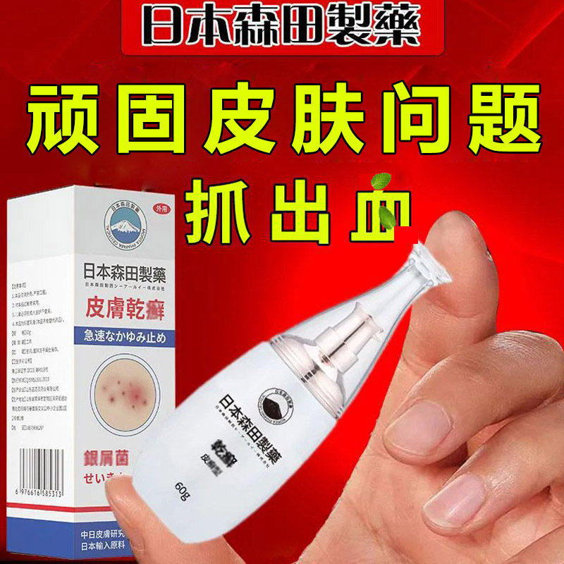日本森田制药进口配方皮肤痒软膏草本无激素脚大腿内侧痒修护肌肤