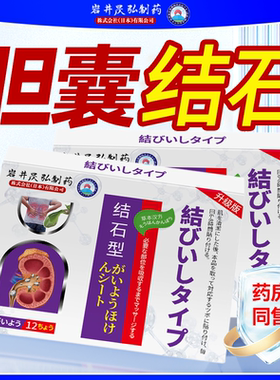 日本岩井昃弘制药疼痛胆囊多发息肉胆结石上腹恶心厌食疼痛结石贴