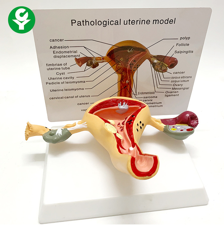 人体女性生殖子宫解剖病理模型阴道卵巢教学模型妇科生殖科教具 全屋定制 扣板吸盘 原图主图