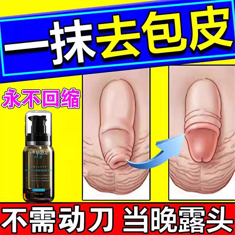 包皮不用割自动脱落修复收缩矫正器包茎过长男用隐形阻复环外翻器