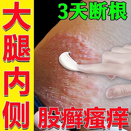 皮康王湿疹止痒去根大腿内侧皮肤阴囊瘙痒药男士隐私部位胯下抑菌