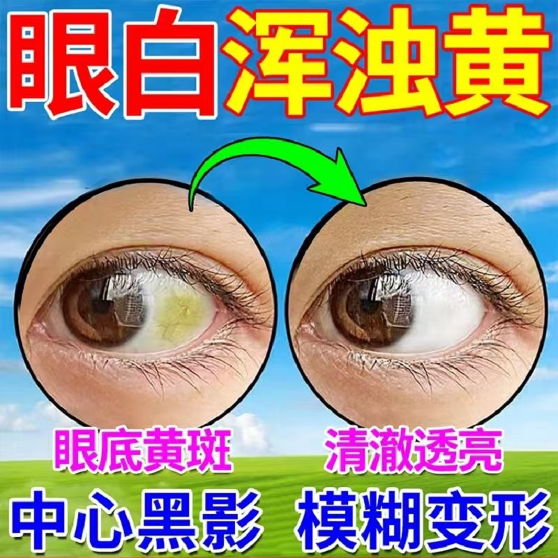 眼白发黄眼睛清澈非去黄红血丝抗疲劳黄斑病变非眼药水叶黄素滴液