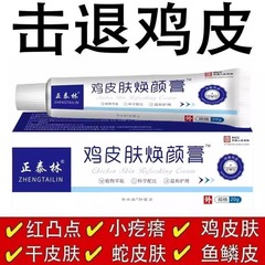 鸡皮肤膏鸡皮焕颜膏身体磨砂软化角质提亮肤色清去鸡皮肤护理乳膏