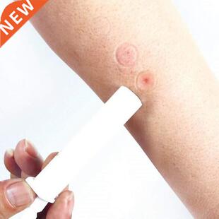 Mosquito Bites Itching Instant Bug Bite Relief Extraction Va