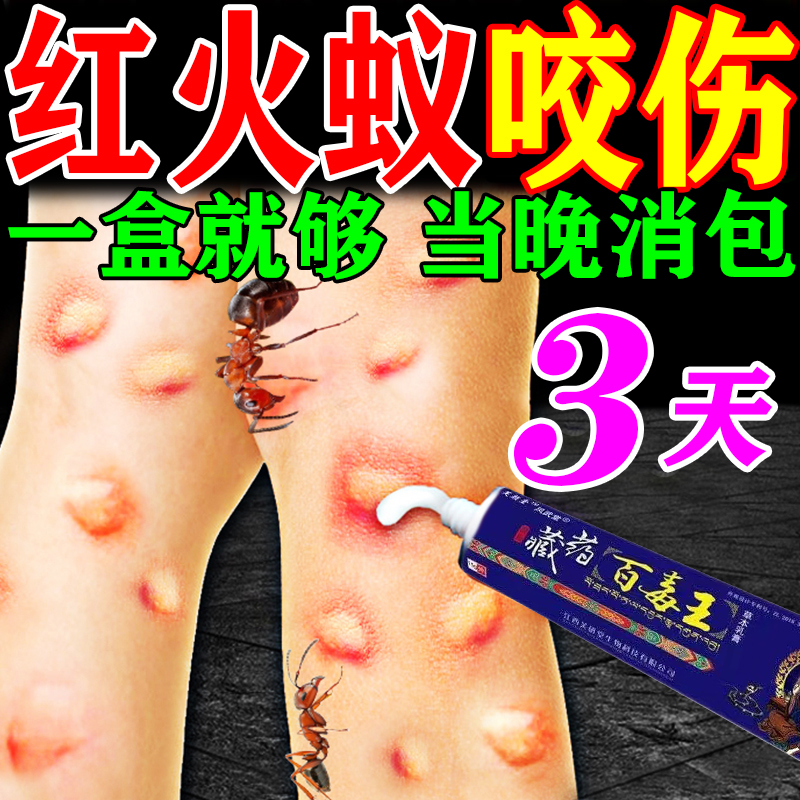 红火蚁蚂蚁咬伤药膏蚊虫叮咬隐翅虫毒虫跳蚤螨虫叮咬消肿外用