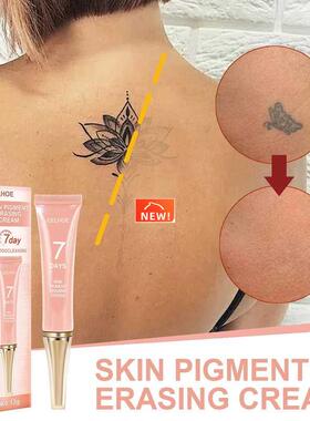 7 Days Permanent Tattoo Removal Cream Skin Tattoos Remover G