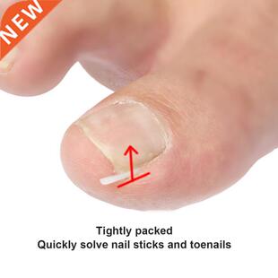 10pcs Ingrown Nail Pad Nail Filling Nail Groove Pad Ingrown