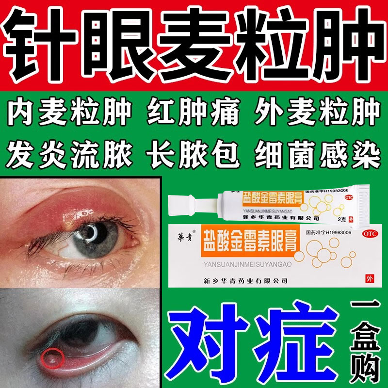 麦粒肿盐酸金霉素眼软药膏正品结膜炎沙眼针眼非滴眼液眼药水5BF OTC药品/国际医药 眼 原图主图