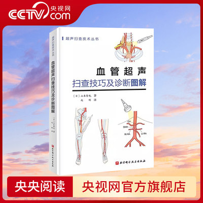 【央视网】血管超声扫查技巧及诊断图解 日本持续畅销 超声扫查技术丛书 血管解剖—扫查方法—诊断要点 一看就明白准确操作 BJ