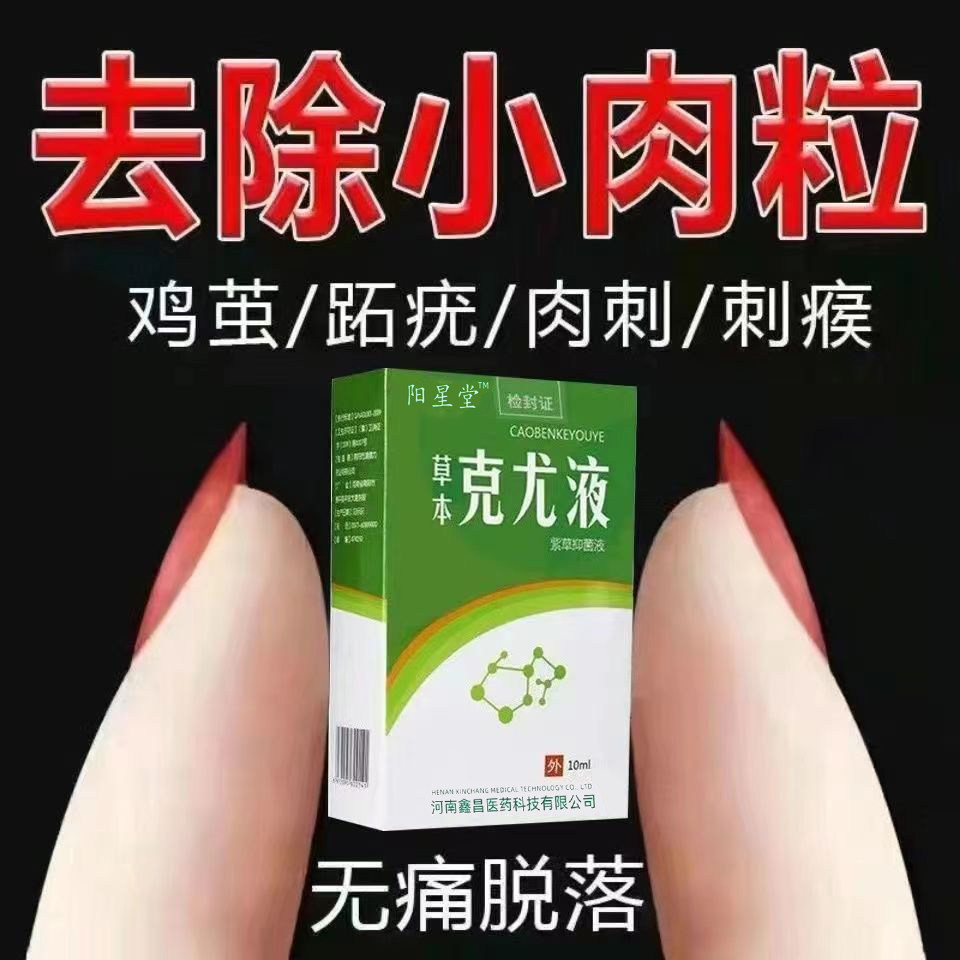 去肉粒疙瘩正品克疣液祛鸡眼黑痣扁平疣湿疣瘊子丝状疣专用跖疣液