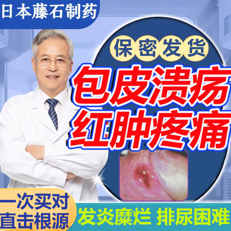 男性包皮炎溃疡裂口消膏性白垢治真菌感染疗男炎龟头炎症白垢qx