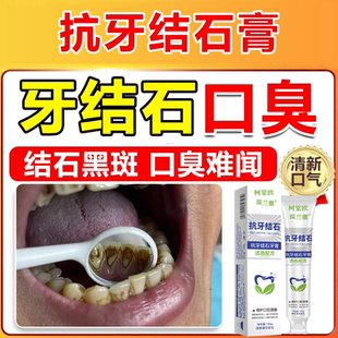 抗牙结石牙垢溶解去除口臭黄牙烟渍清新口气清理洁清除神器漱口wg