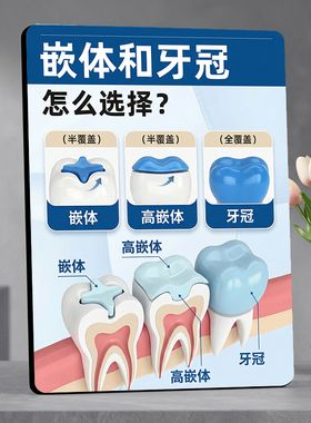 嵌体和牙冠选择口腔门店项目宣传桌面摆件