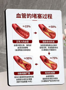 血管堵塞过程美容院店内项目宣传桌面摆件