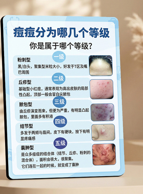 美容院祛痘知识宣传摆台痘痘等级划分展示摆件护肤店桌面装饰