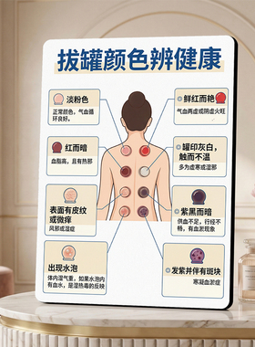 拔罐颜色辨健康装饰摆件养生馆理疗店中医知识展示立牌