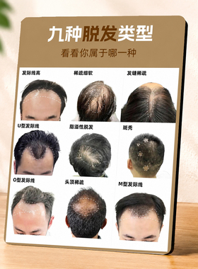 养发馆理发店九种脱发类型科普展示装饰门店桌面立牌摆件