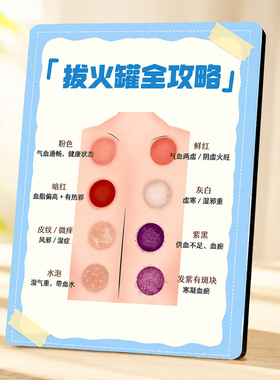 创意拔火罐全攻略科普小摆件中医养生馆装饰实用桌面摆台
