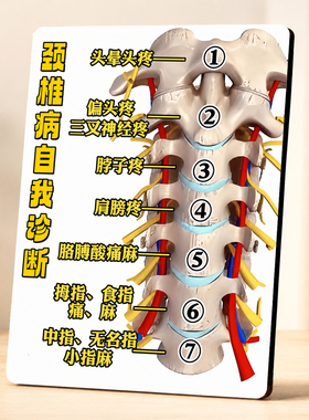 颈椎病自我诊断展示摆件养生馆中医馆家用门店桌面装饰摆台