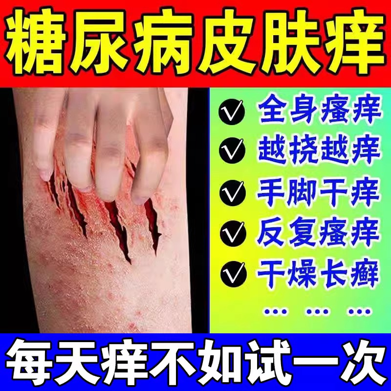 糖尿病皮肤痒止痒膏治老年人皮肤