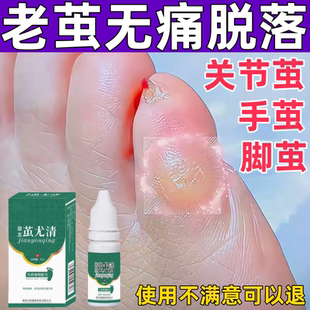 清茧灵老茧软化剂脚底茧净立根脚茧手茧脚上死皮硬皮脚垫神器去除