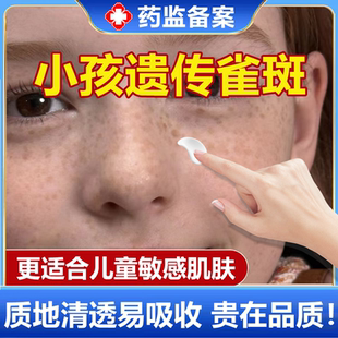 儿童脸上遗传雀斑点斑祛斑霜小孩淡化黑色素褐色斑药监备案膏wg