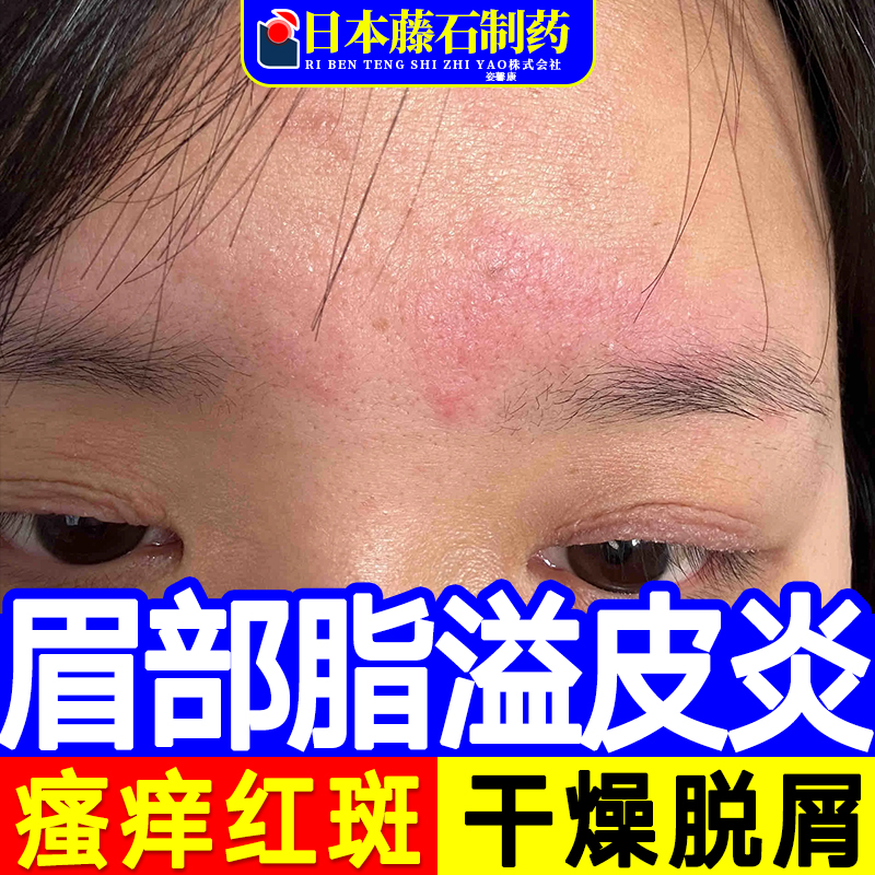 【医用皮肤修复凝胶】