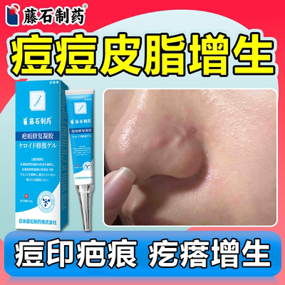 去鼻子痘痘疤痕疙瘩增生凝胶