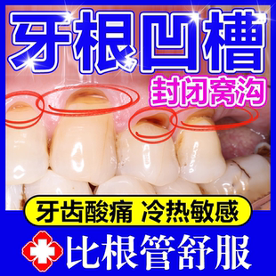 牙根发黑凹槽牙洞修防蛀牙龋齿复牙齿楔状缺损口腔牙龈冷热敏感wg