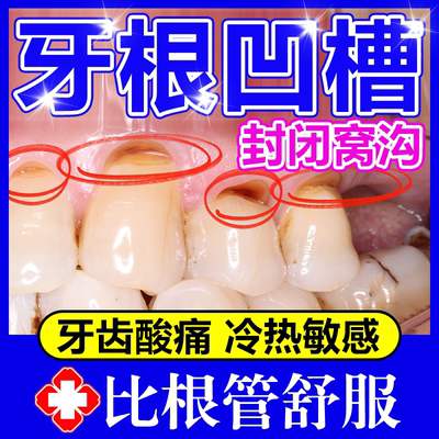 牙根发黑凹槽牙洞防蛀牙龋齿修复