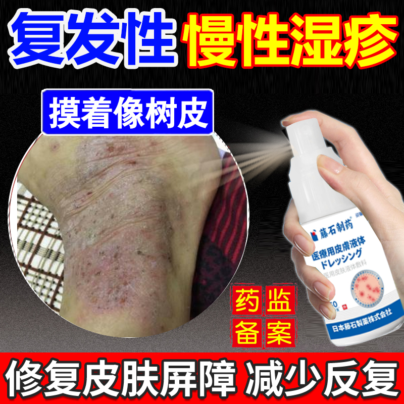 【药监局备案】慢性湿疹喷雾剂