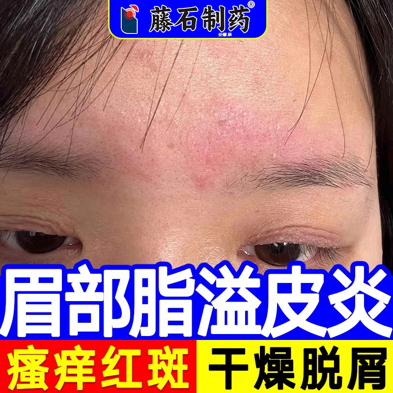 【医用皮肤修复凝胶】