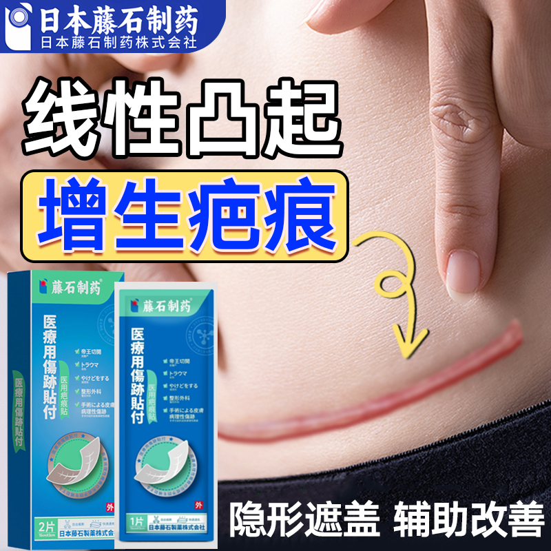 硅酮疤痕贴术后剖腹产双眼皮甲状腺修护增生疤痕凸起去除疙瘩hy