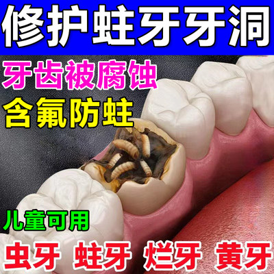 【含氟牙膏】防腐蚀防蛀儿童可用