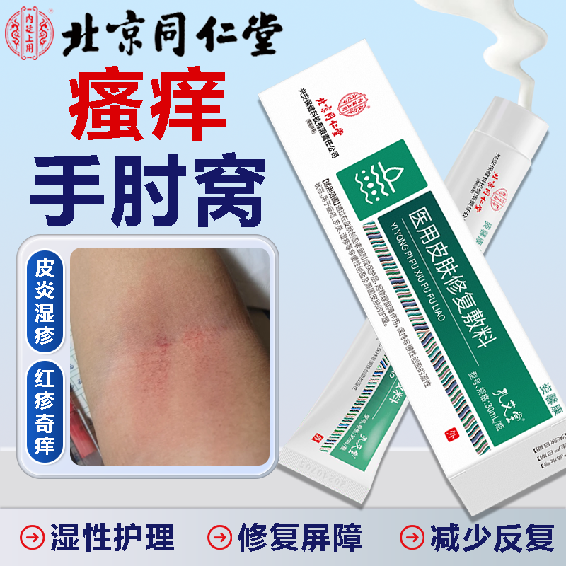 【北京同仁堂】手肘窝皮炎湿疹痒