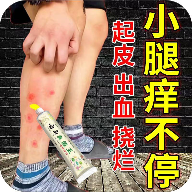 百草真菌王快速止痒软膏