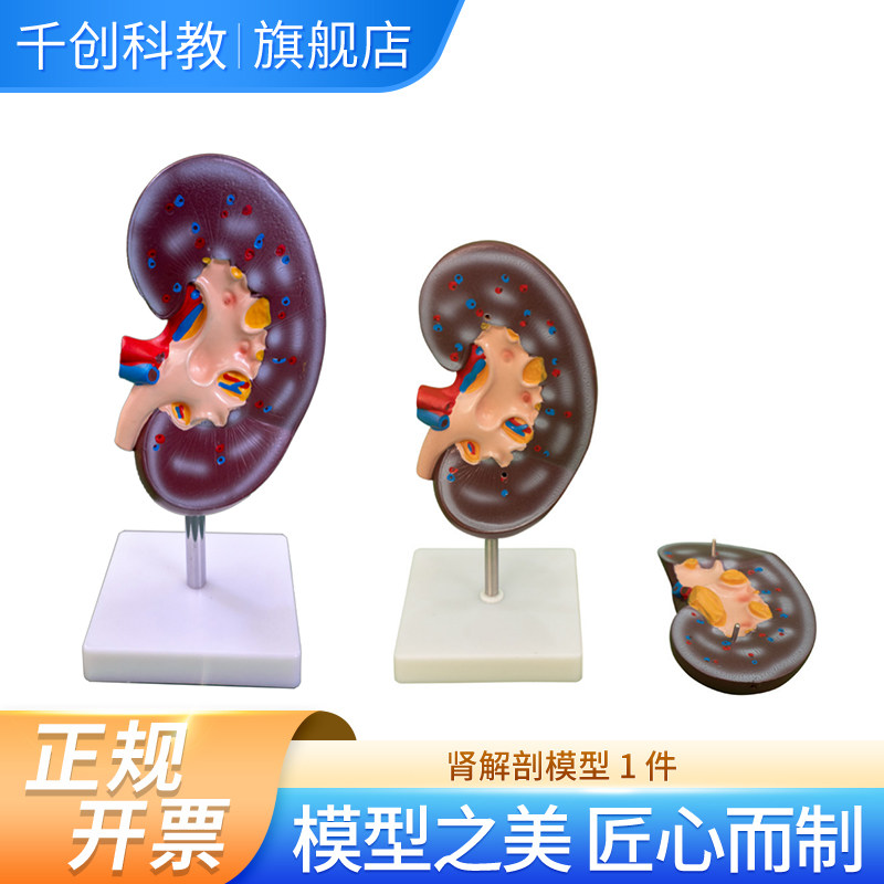 肾解剖模型2倍放大右肾额状切面展示肾门血管输尿管肾盂皮质髓质锥体乳头医学教学解剖教具