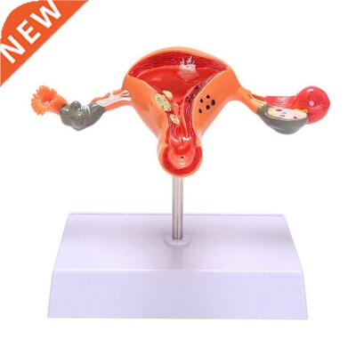 Uterus Model Ovary Model Anatomy Female Reproductive Organ M