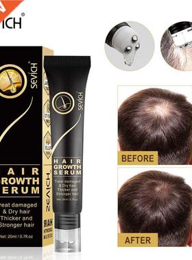 Sevich Hair Growth Oil Ginger Extract Growing Serum Prevent